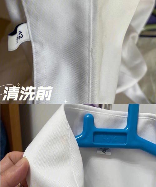 流汗后衣服上有白色印什么原因
，衣服干了有白色的汗渍，是什么原因？图1