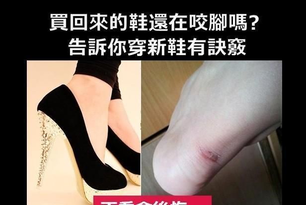 买的新鞋磨脚怎么办？
，新买的鞋子会磨脚怎么办？图1