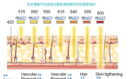 强脉冲光和激光的区别
，脉冲激光和半导体激光区别？图2